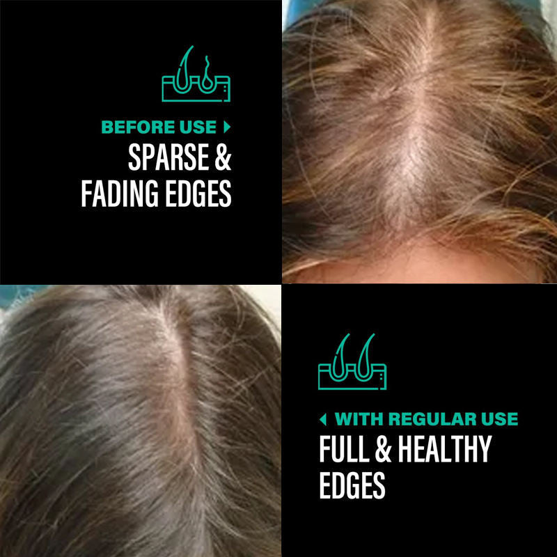 OEM ODM Raw Batana Oil For Hair Growth 100 Percent Pure Batana Oil From Honduras For Thick And Strong Natural Hair Oil