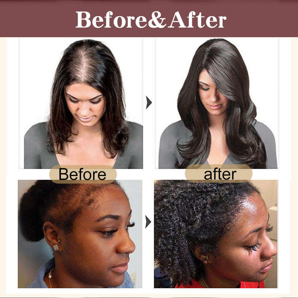 OEM ODM Raw Batana Oil For Hair Growth 100 Percent Pure Batana Oil From Honduras For Thick And Strong Natural Hair Oil