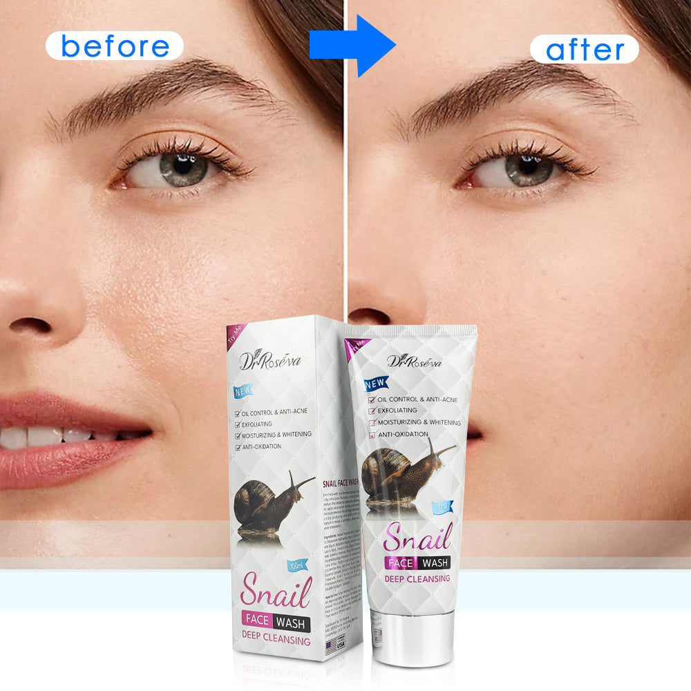 DR.ROSEVA Snail Facial Private Label Factory Customize Face Wash Smooth And Moisturized Skin Care Set