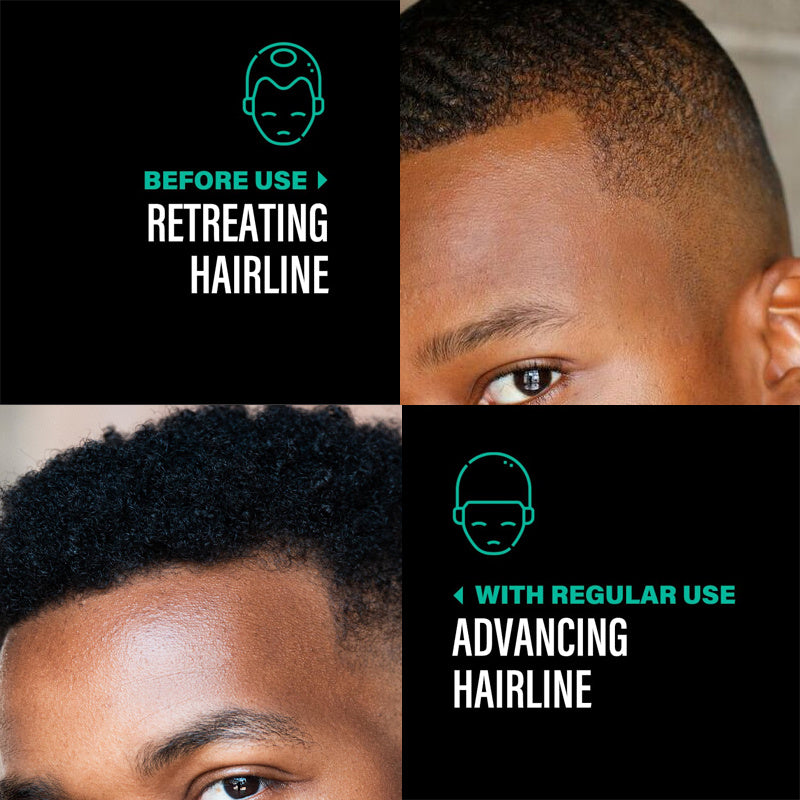 OEM ODM Raw Batana Oil For Hair Growth 100 Percent Pure Batana Oil From Honduras For Thick And Strong Natural Hair Oil